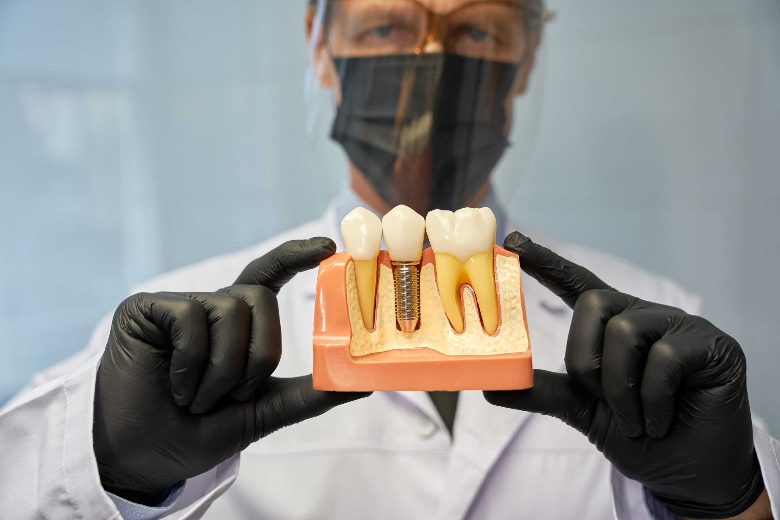 Selective focus photo of man in protective mask and face shield holding a model of teeth with an implant